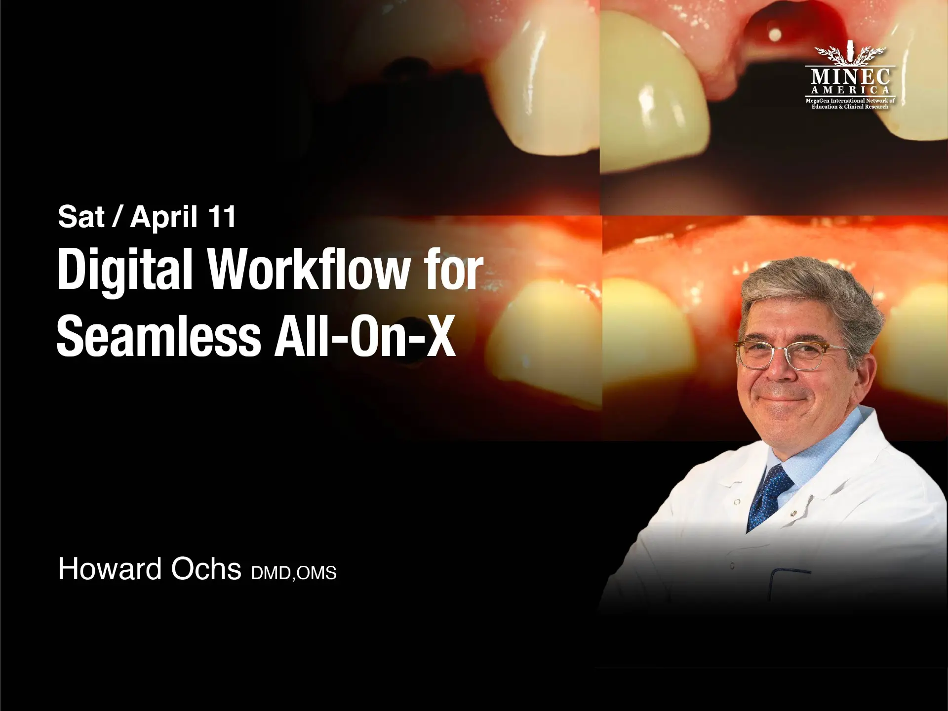 Digital Workflow for  Seamless All-On-X - April