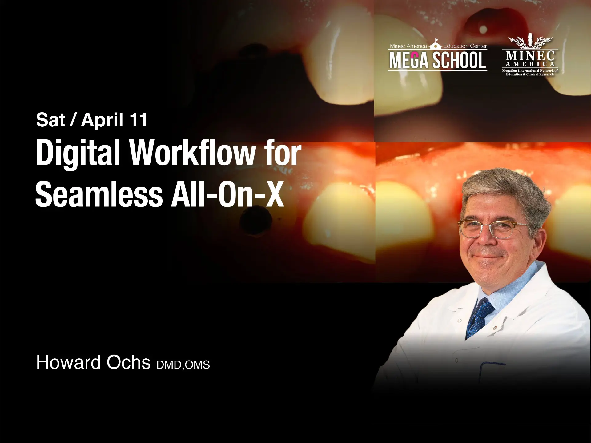 Digital Workflow for  Seamless All-On-X - April