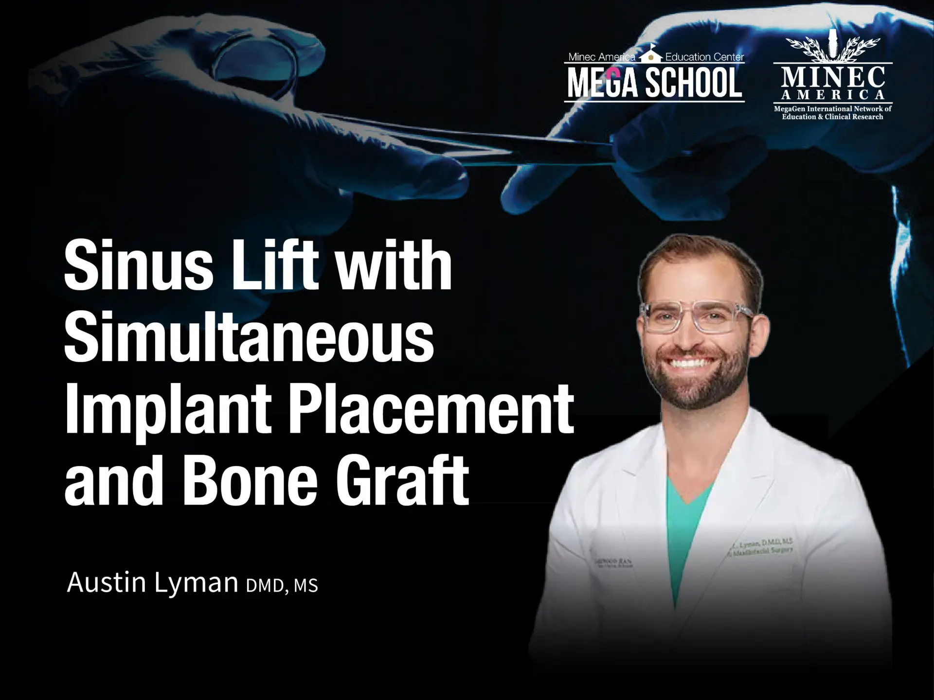 Sinus Lift with Simultaneous Implant Placement and Bone Graft -May