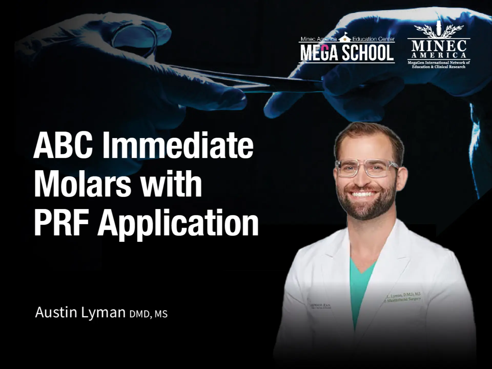 ABC Immediate Molars with PRF Application