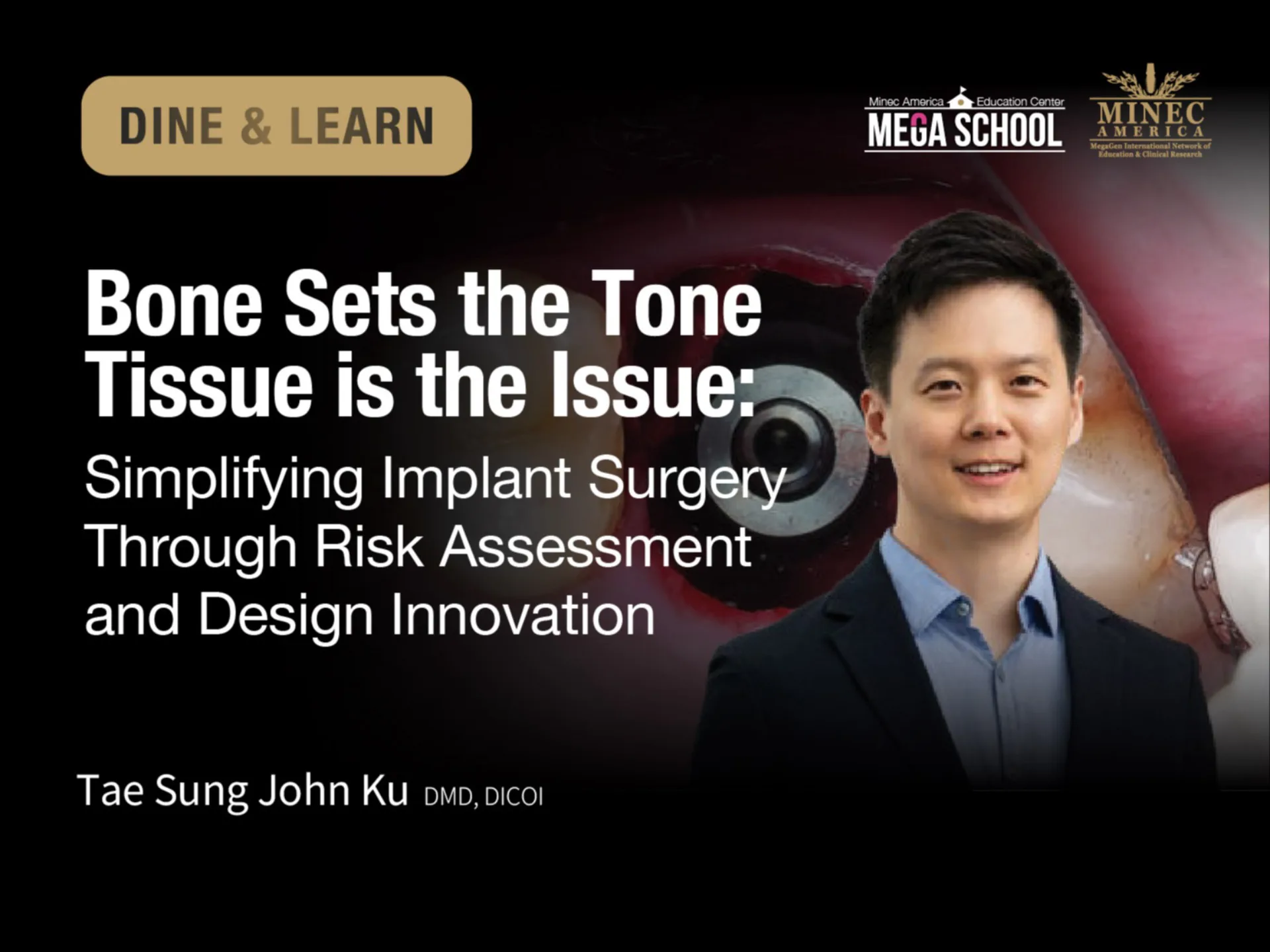 DINE & LEARN: Bone Sets the Tone Tissue is the Issue: Simplifying Implant Surgery Through Risk Assessment and Design Innovation (NV) 