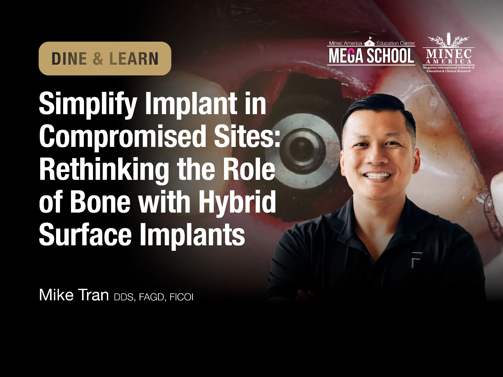Dine & Learn: Simplify Implant in  Compromised Sites: Rethinking the role  of bone with hybrid surface implants (TX) 